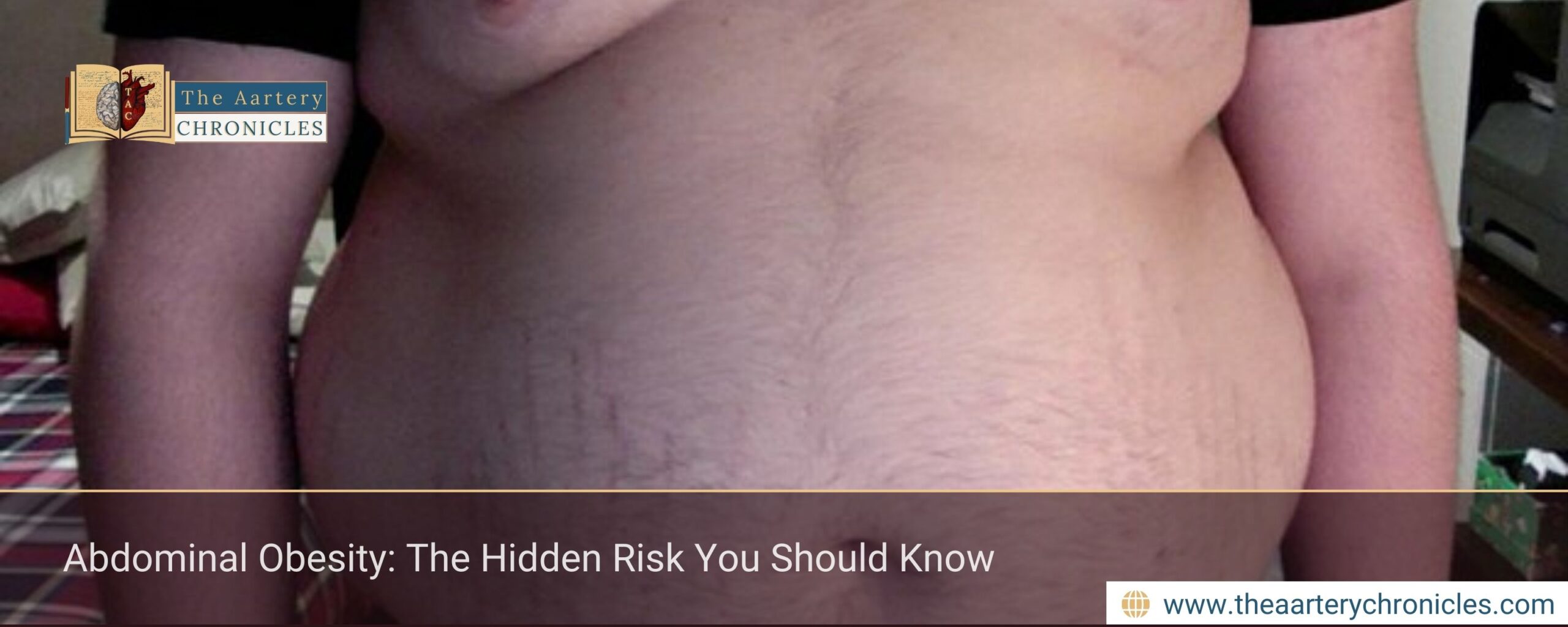 Abdominal Obesity: The Hidden Risk You Should Know