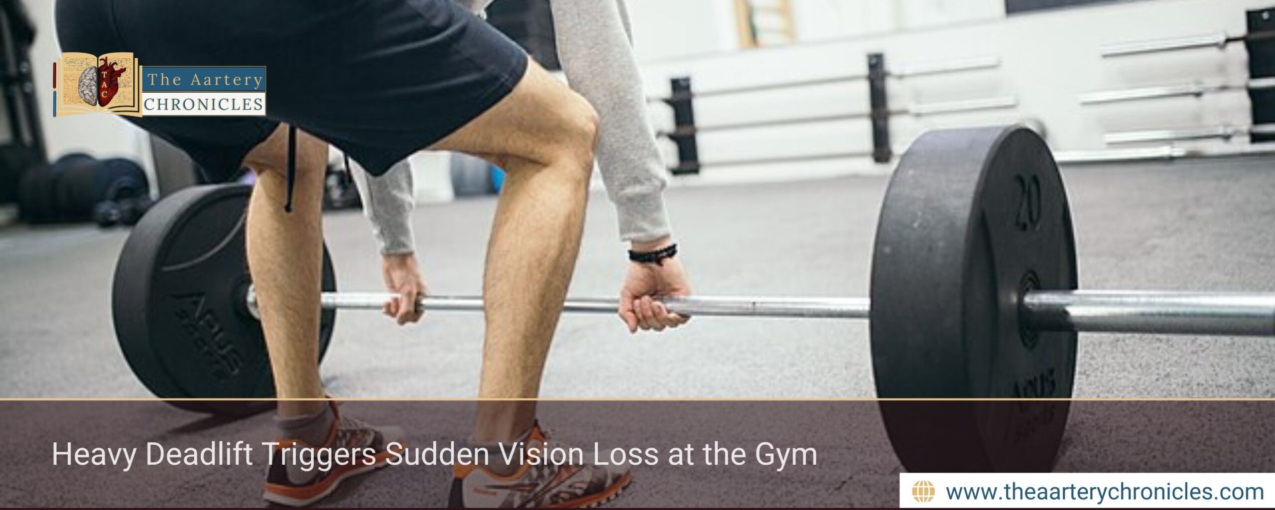 Heavy Deadlift Triggers Sudden Vision Loss at the Gym