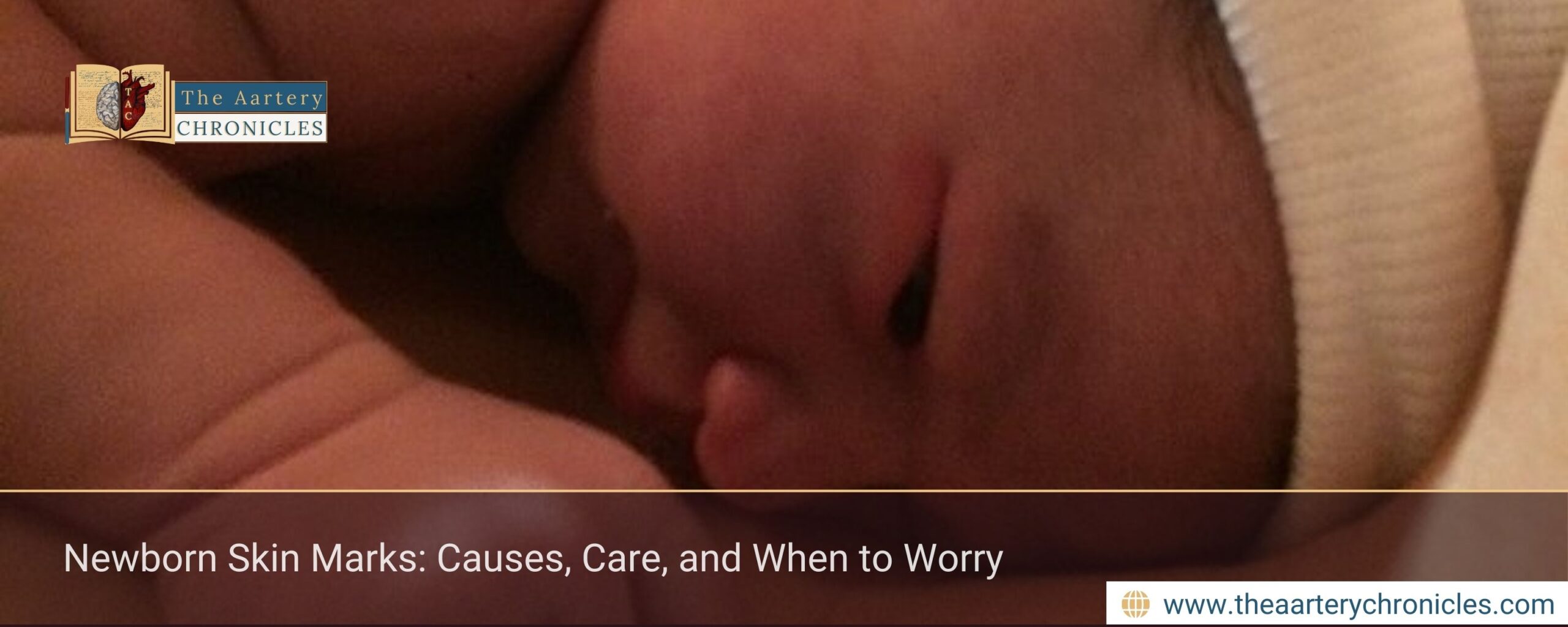 Newborn Skin Marks: Causes, Care, and When to Worry