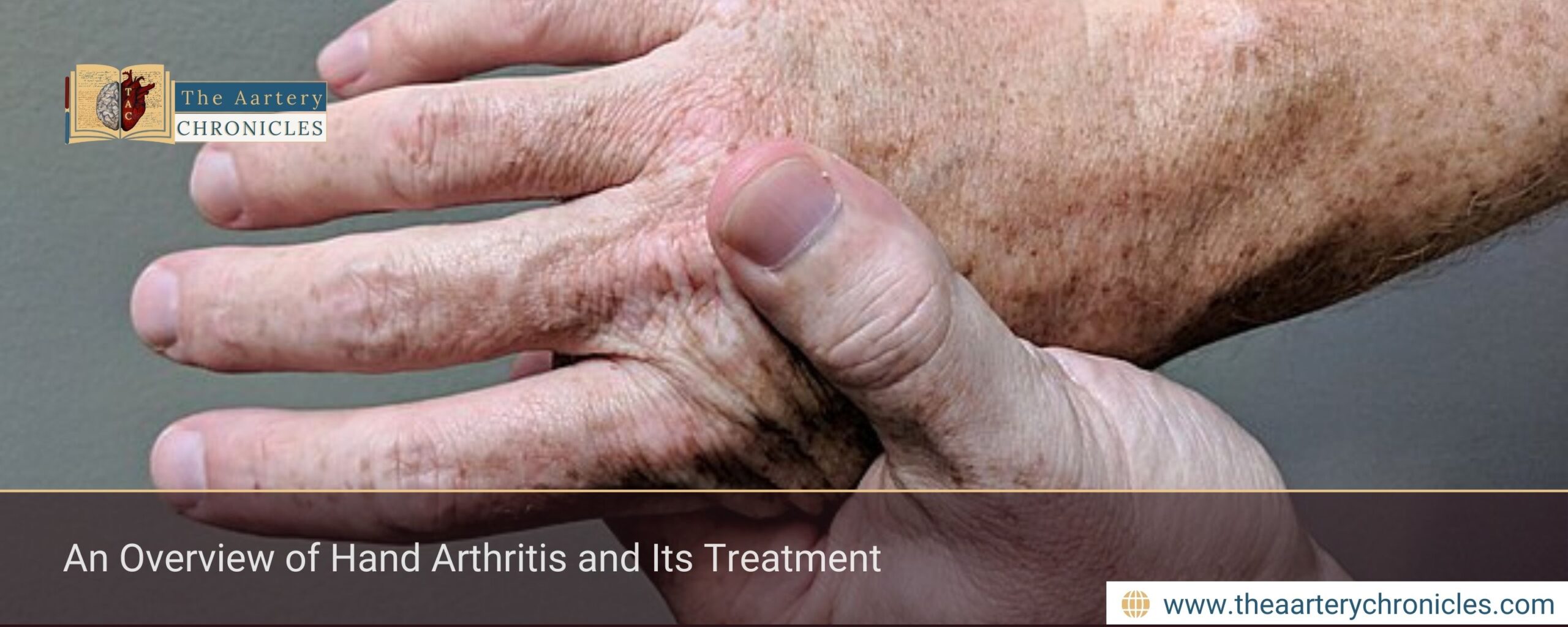 Learn the symptoms, causes, and treatments of hand arthritis and how it affects daily life. Expert tips on pain relief and management.