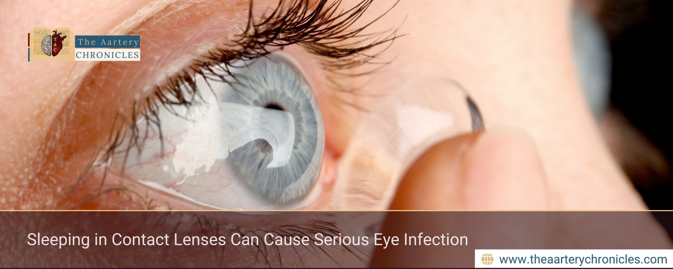 Sleeping in Contact Lenses Can Cause Serious Eye Infection