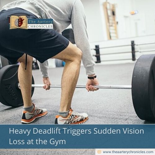 Heavy Deadlift Triggers Sudden Vision Loss at the Gym