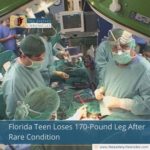 Florida Teen Loses 170-Pound Leg After Rare Condition