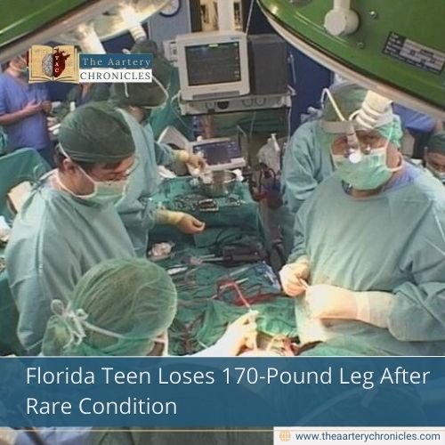 Florida Teen Loses 170-Pound Leg After Rare Condition