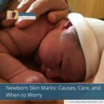Newborn Skin Marks: Causes, Care, and When to Worry