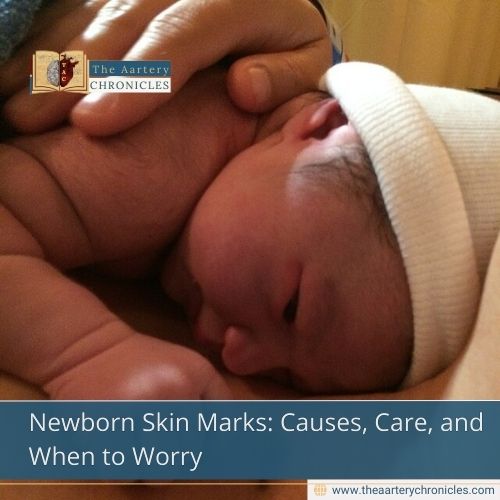 Newborn Skin Marks: Causes, Care, and When to Worry