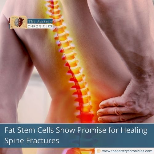New Spine Healing Technique Uses Fat Stem Cells