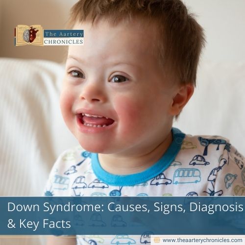 Down Syndrome: All that you need to Know