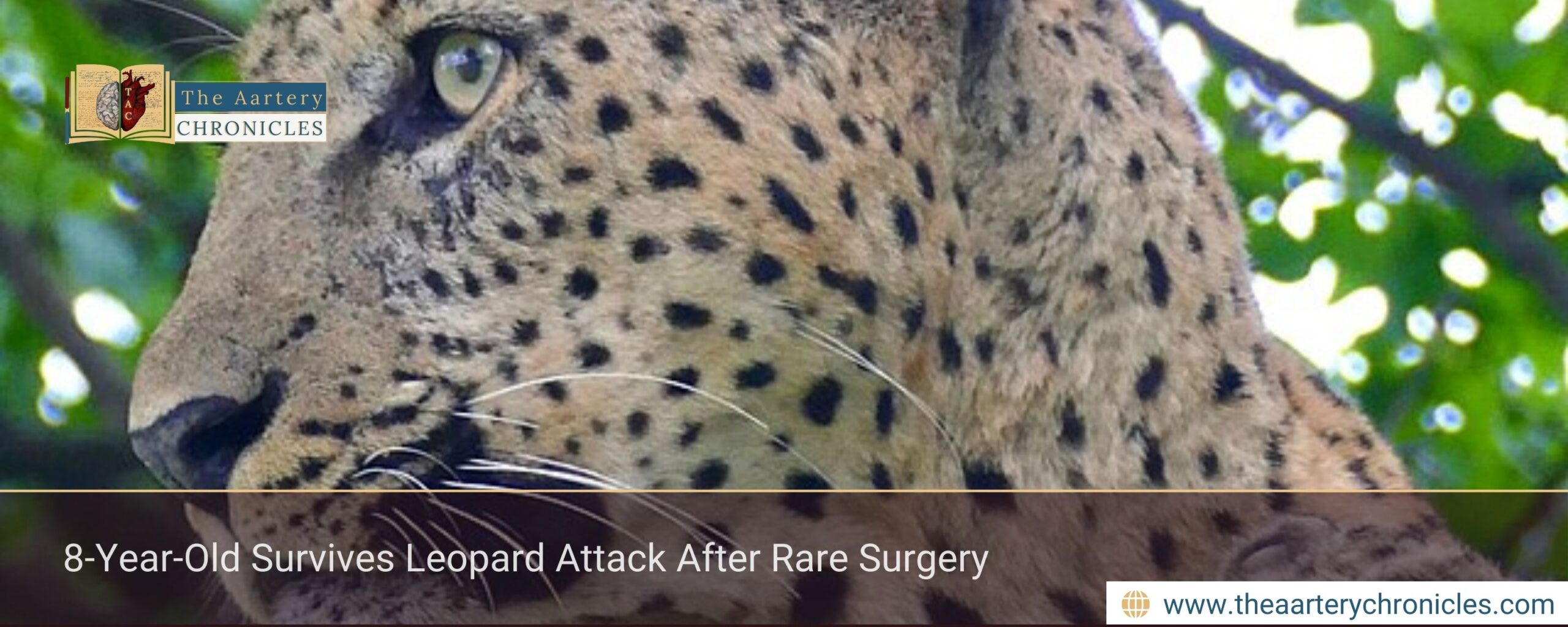 8-Year-Old Survives Leopard Attack After Rare Surgery