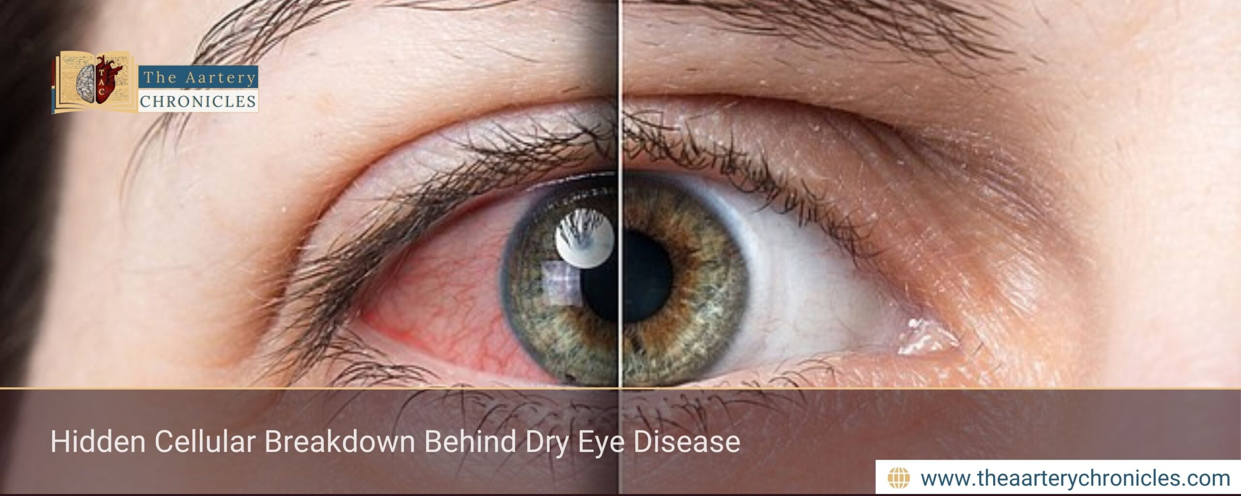 hidden-cellular-breakdown-behind-dry-eye-disease-the-aartery-chronicles-tac