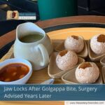 Jaw Locks After Golgappa Bite, Surgery Advised Years Later