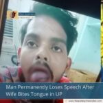 Man Permanently Loses Speech After Wife Bites Tongue in UP