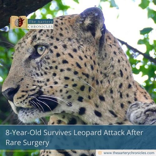 8-Year-Old Survives Leopard Attack After Rare Surgery