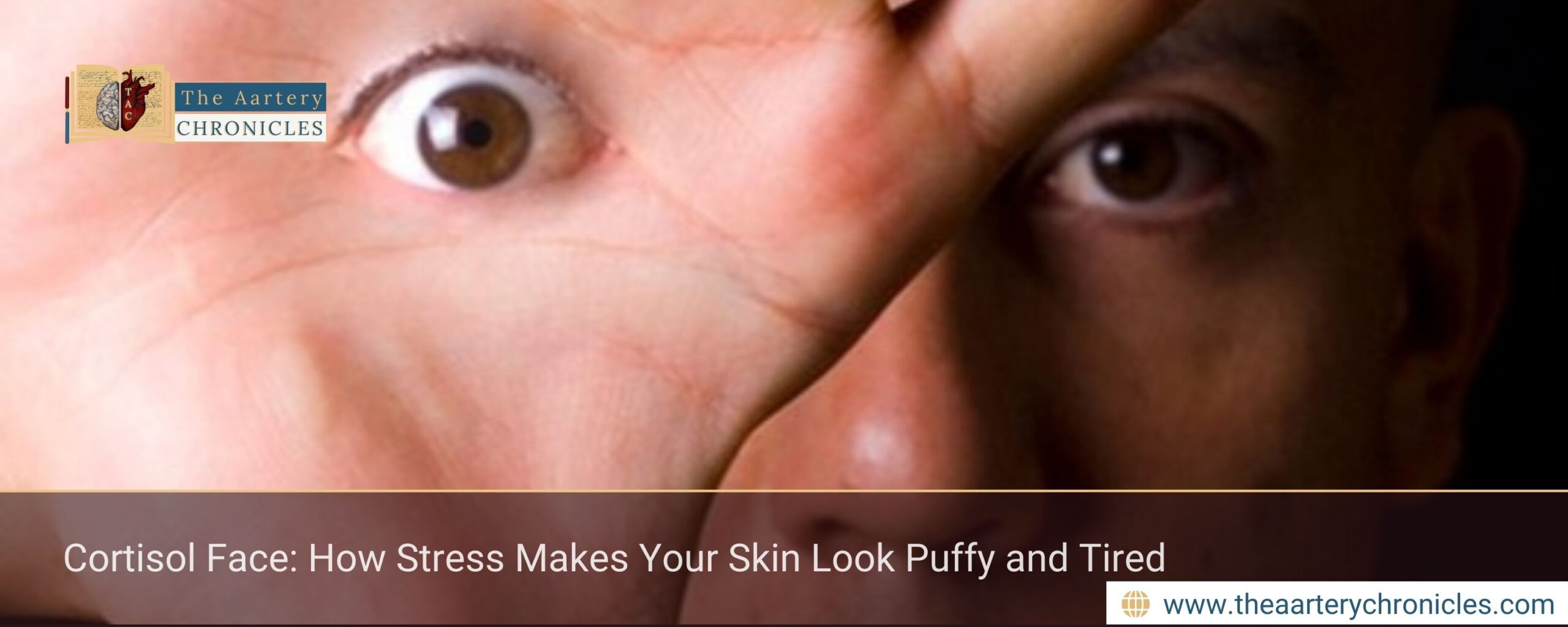 Cortisol Face: How Stress Makes Your Skin Look Puffy and Tired