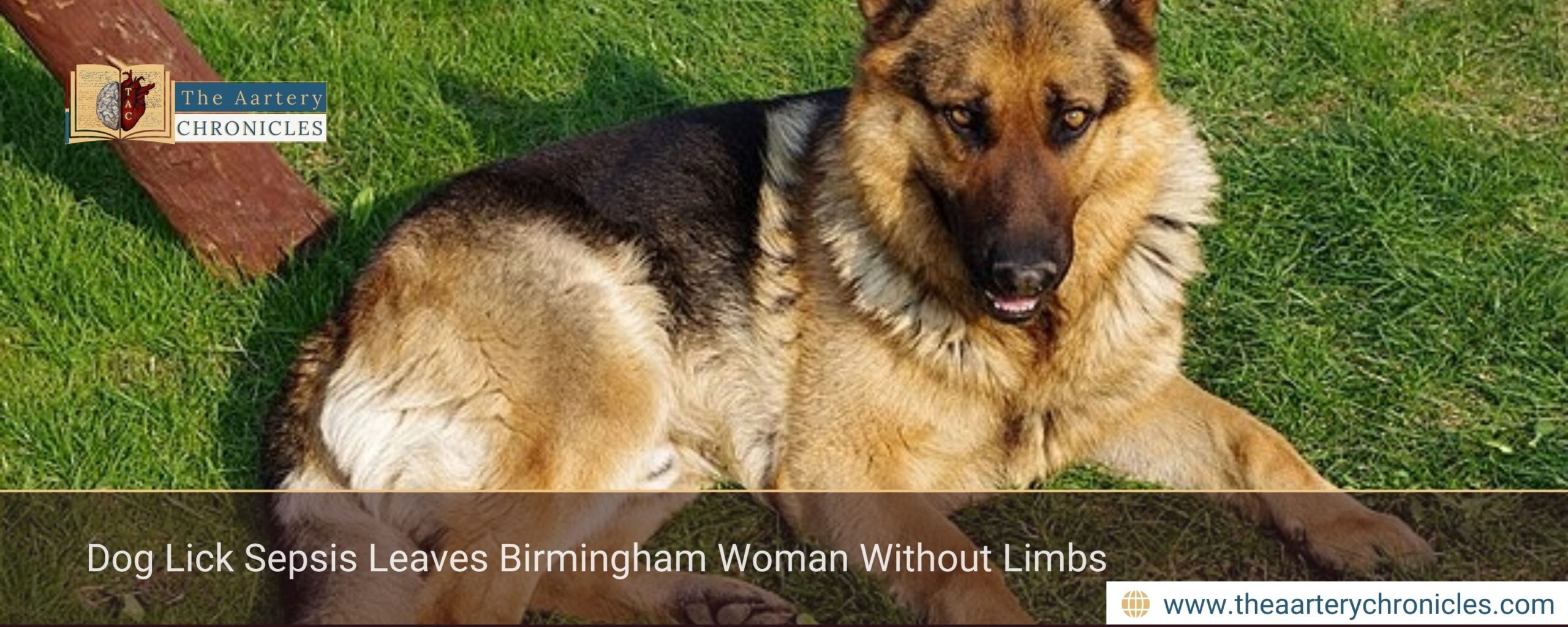 Dog Lick Sepsis Leaves Birmingham Woman Without Limbs
