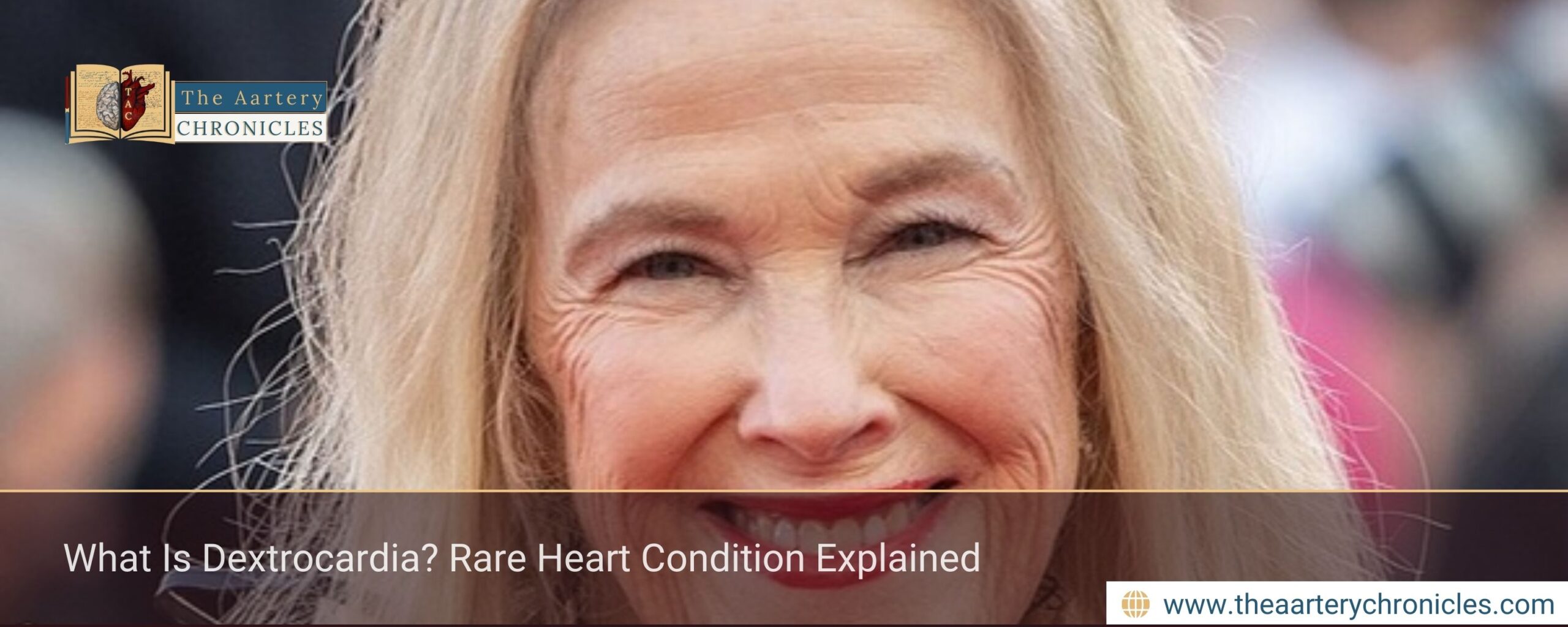 What Is Dextrocardia? Rare Heart Condition Explained