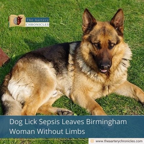 Dog Lick Sepsis Leaves Birmingham Woman Without Limbs