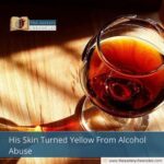 His Skin Turned Yellow From Alcohol Abuse