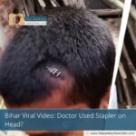 Bihar Viral Video: Doctor Used Stapler on Head?