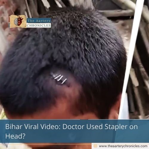 Bihar Viral Video: Doctor Used Stapler on Head?