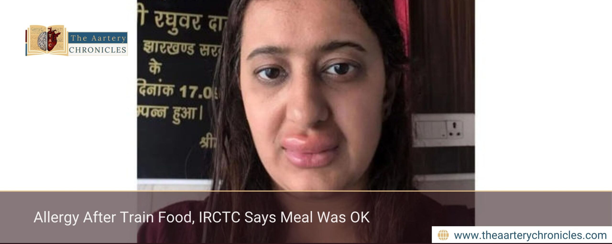 Allergy After Train Food, IRCTC Says Meal Was OK