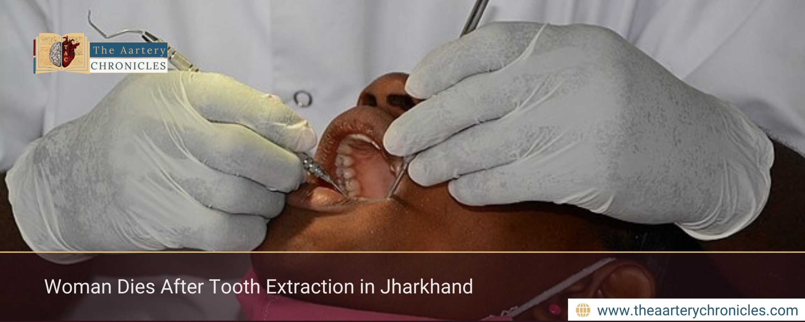 Woman Dies After Tooth Extraction in Jharkhand