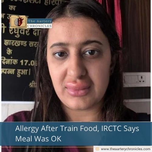 Allergy After Train Food, IRCTC Says Meal Was OK