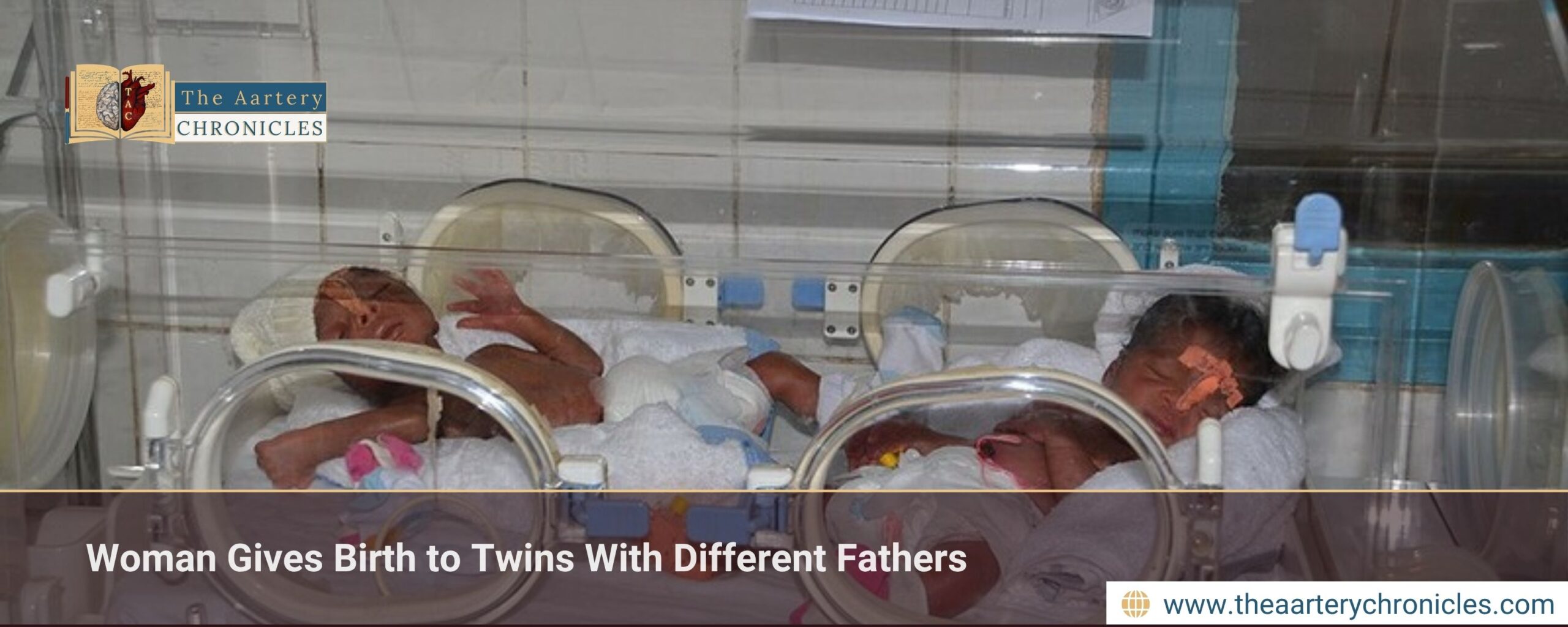 Woman Gives Birth to Twins With Different Fathers