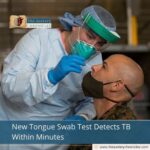 New Tongue Swab Test Detects TB Within Minutes